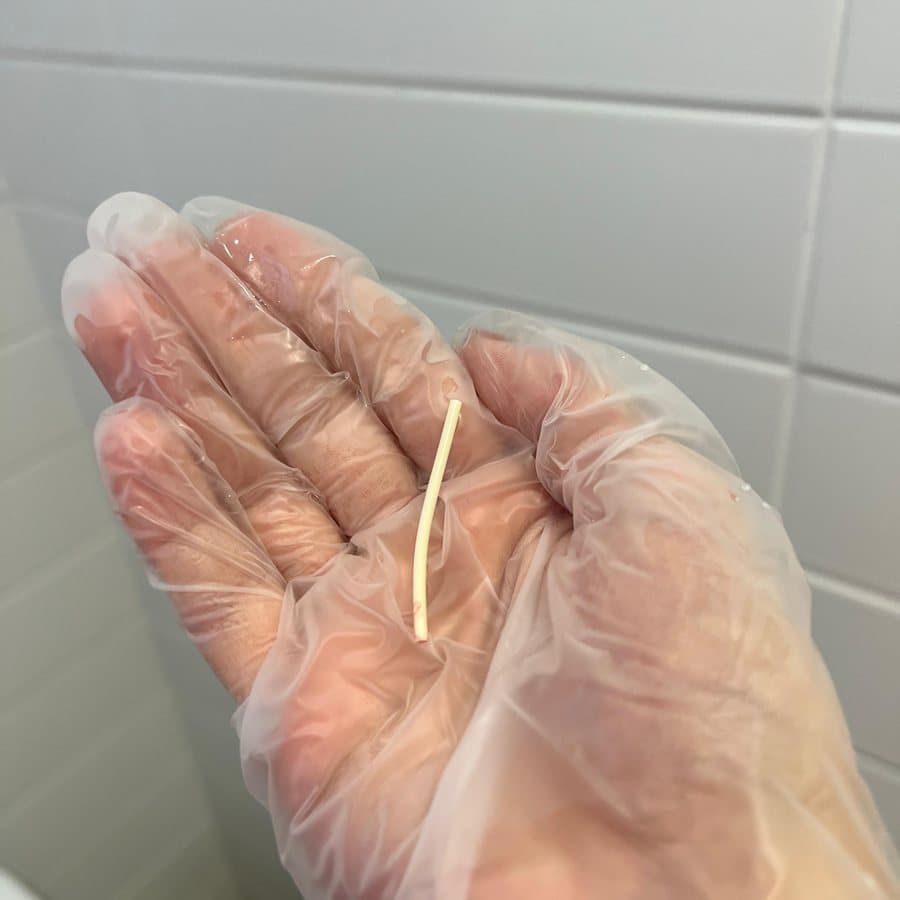 Implante contraceptivo subdérmico sobre a mão enluvada, mostrando o tamanho real