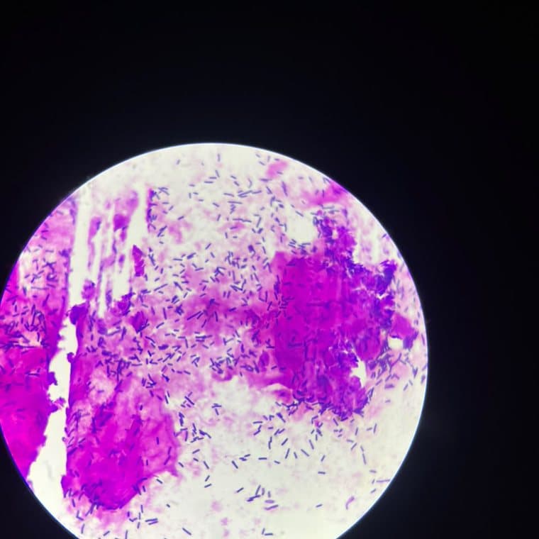 Lâmina de conteúdo vaginal com células epiteliais e grande quantidade de bacilos